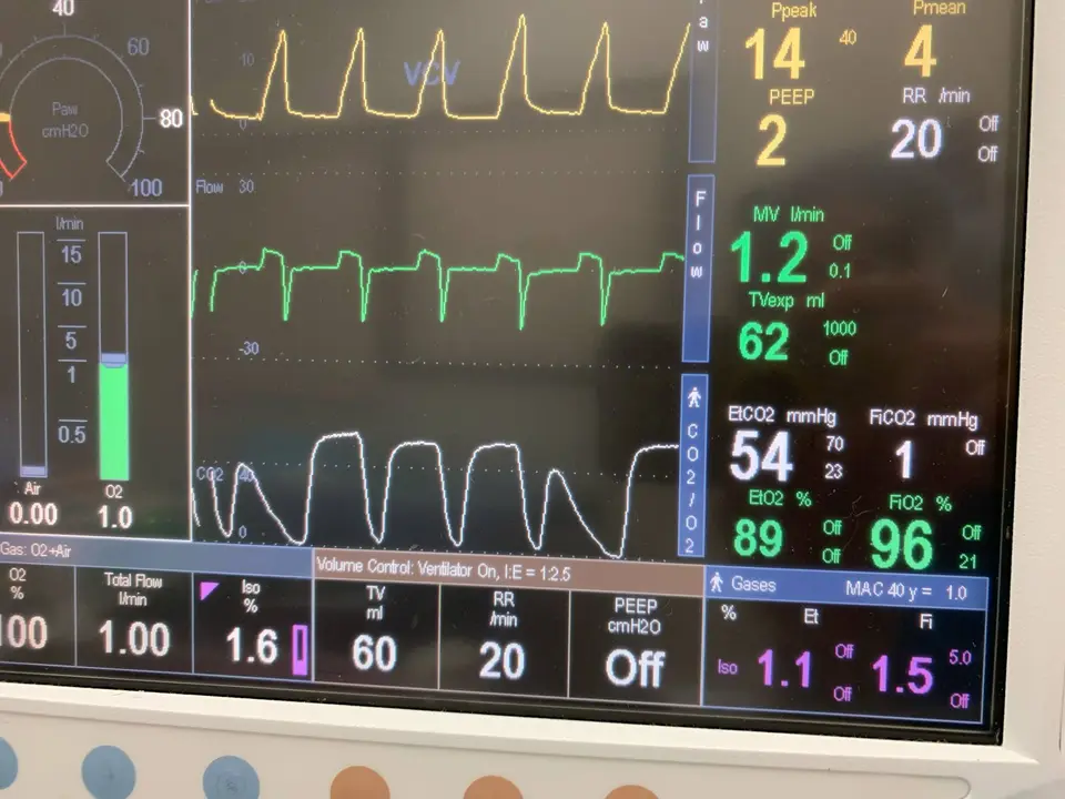 Specialized anesthesia machine and accessories