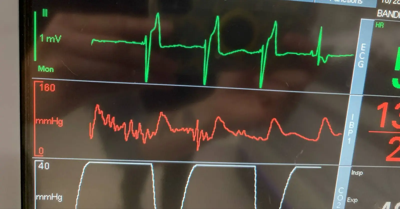 Anesthesia monitoring equipment in a veterinary setting